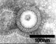 Electron microscopy of pandemic influenza H5N1 VLPs