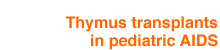 Thymus transplants in pediatric AIDS