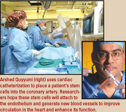 Arshed Quyyumi uses cardiac catheterization to place a patient's stem cells into the coronary artery. Researchers hope these stem cells will attach to the endothelium and generate new blood vessels to improve circulation in the heart