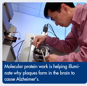 Molecular protein work is helping illuminate why plaques form in the brain to cause Alzheimer's