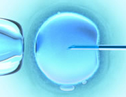 Donor egg in-vitro fertilization